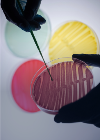 Researcher preparing a petri dish